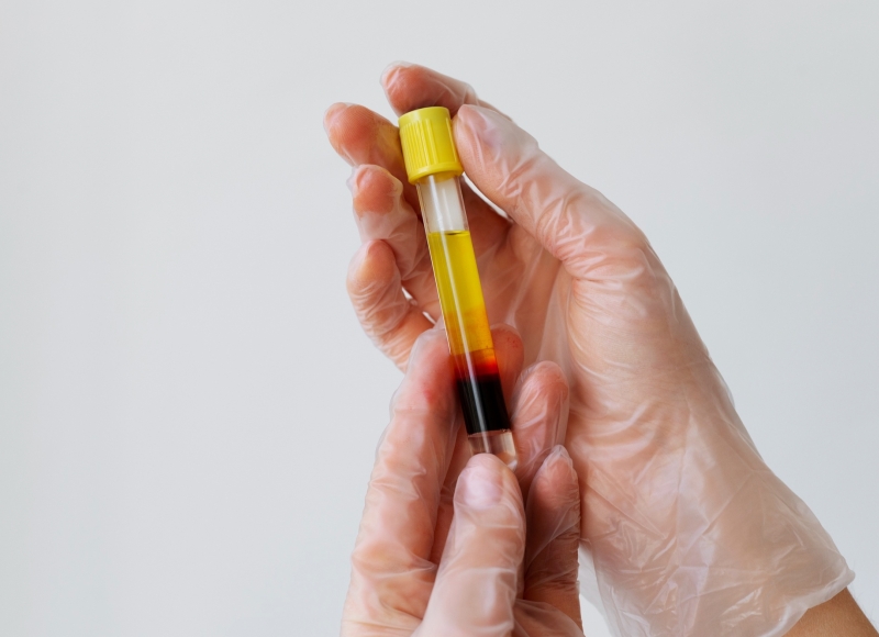 JULHO é o mês de luta contra as Hepatites Virais: Faça o teste rápido para Hepatites B e C!